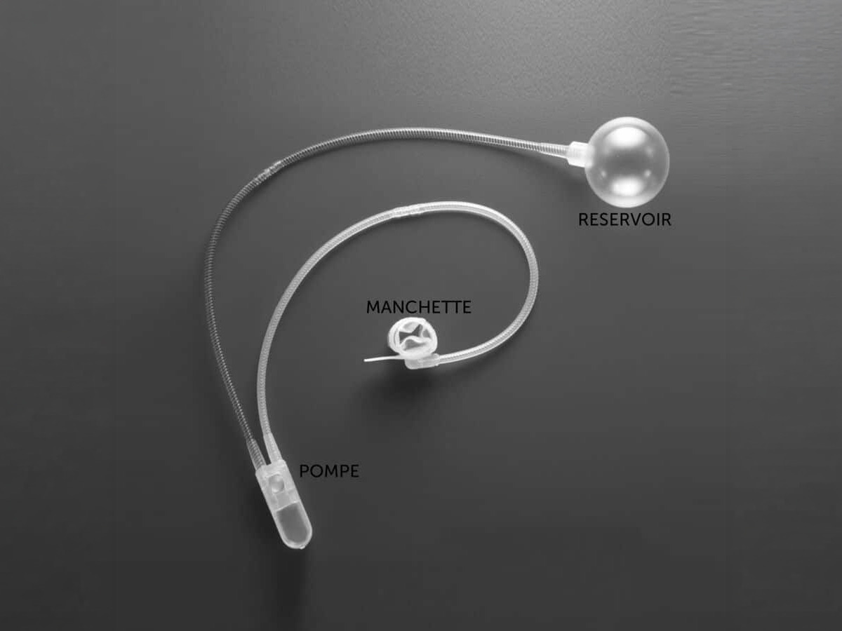 2. sphincter artificiel urinaire ams 800 600x596 2. sphincter artificiel urinaire ams 800 600x596