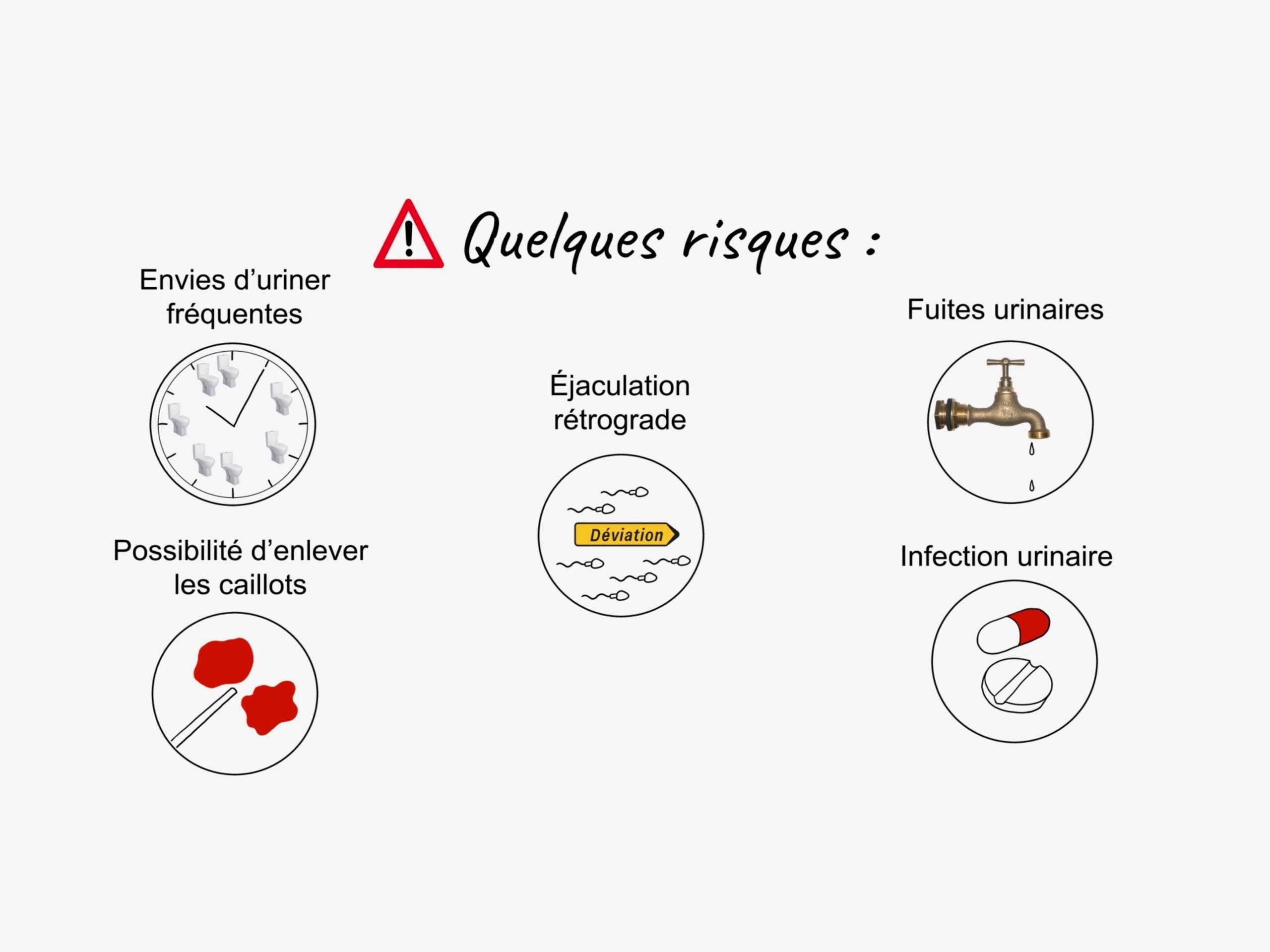 7 risques de lintervention 1