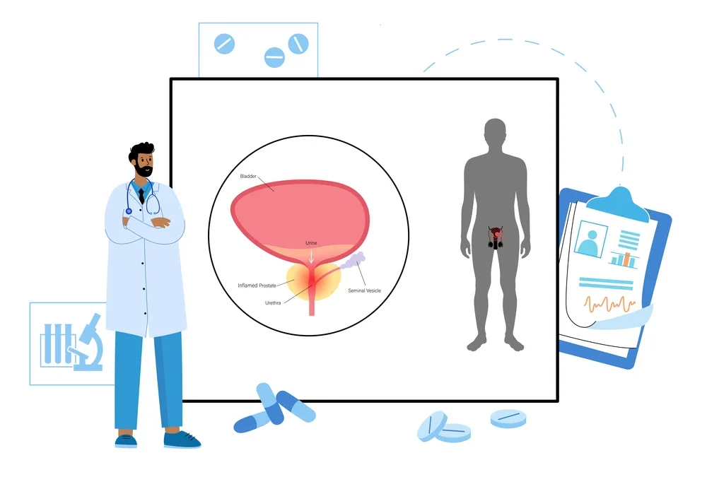 illustration d'un médecin qui encadre un patient pendant son examen de la prostate via des cachets et des schémas