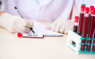Cancer de la prostate : à partir de quel taux de PSA s&rsquo;inquiéter ?