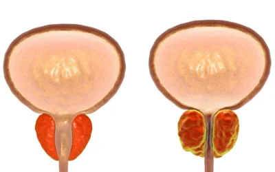 Quels sont les signes d’un problème de prostate ?