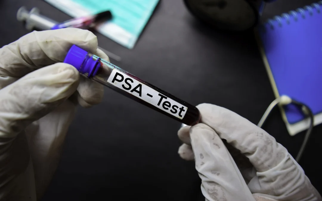 Interprétation du Taux de PSA : Un Guide Complet pour les Hommes