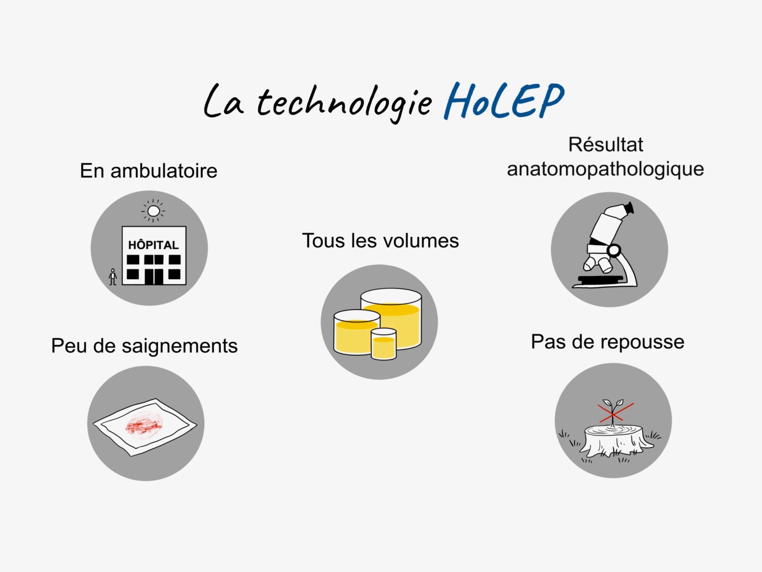 5 avantages de la technologie holep 600x399